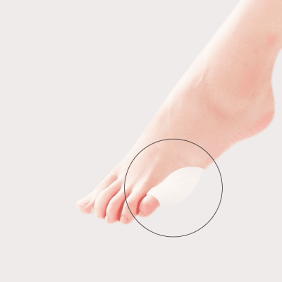 PROTECTOR JUANETES MEÑIQUE GEL X PAR PURA+