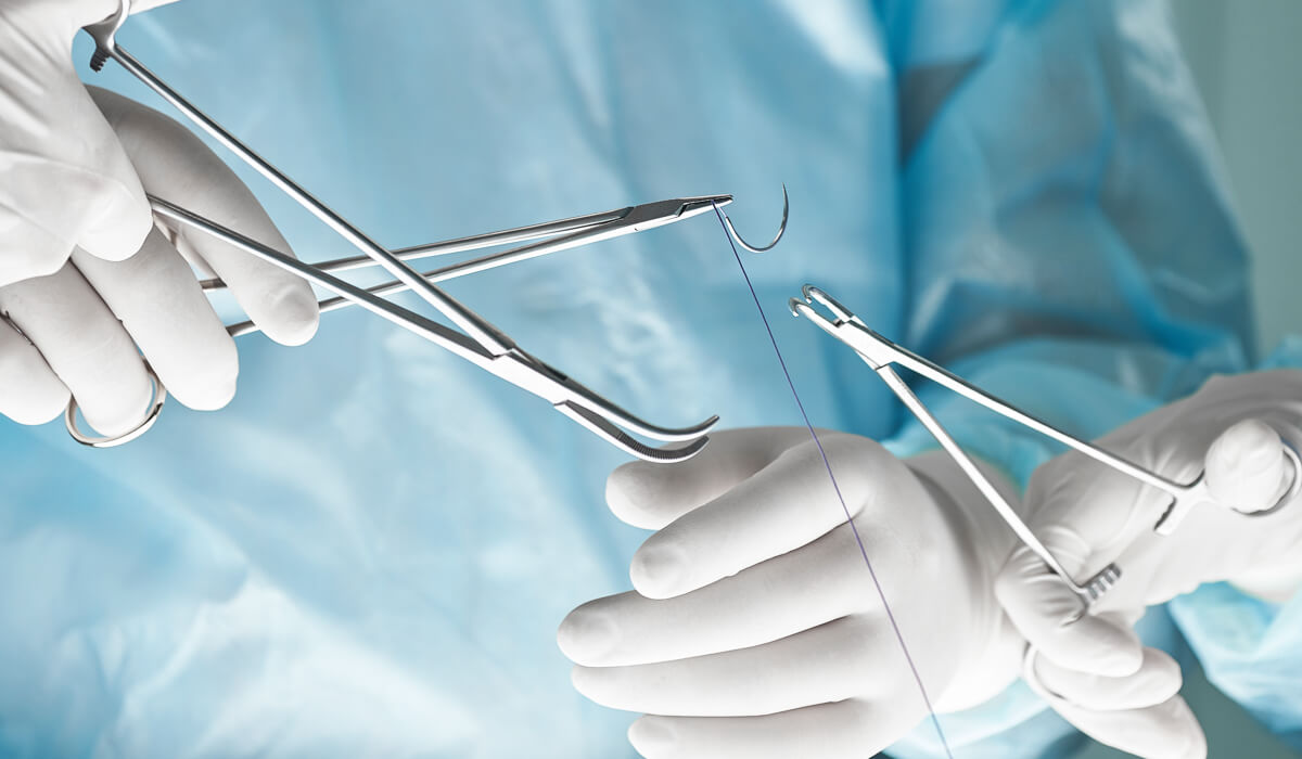 Suturas, la magia oculta detrás de una buena recuperación