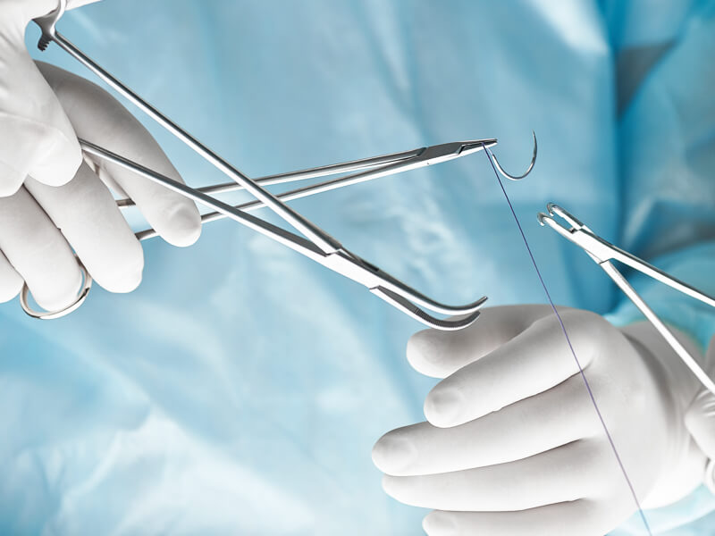 Suturas, la magia oculta detrás de una buena recuperación